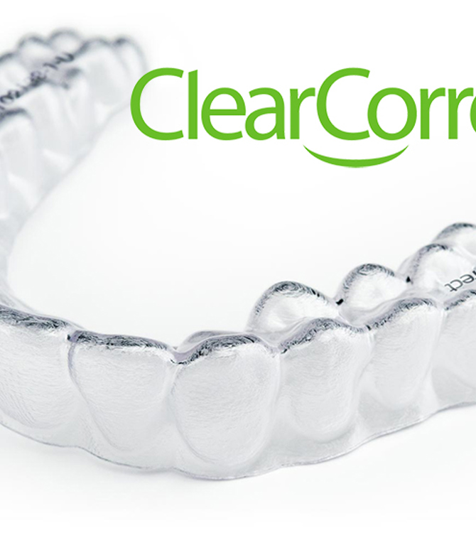 Clear Aligners Consultation 